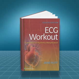 ECG Workout Exercises in Arrhythmia Interpretation 8th Edition PDF
